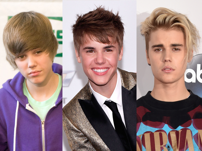 Justin Bieber Hair Transplant: Everything You Need to Know About Justin’s Hairline