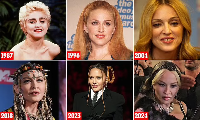 Madonna Plastic Surgery