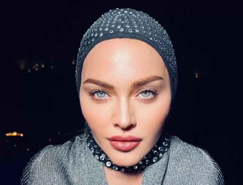Madonna Face Plastic Surgery