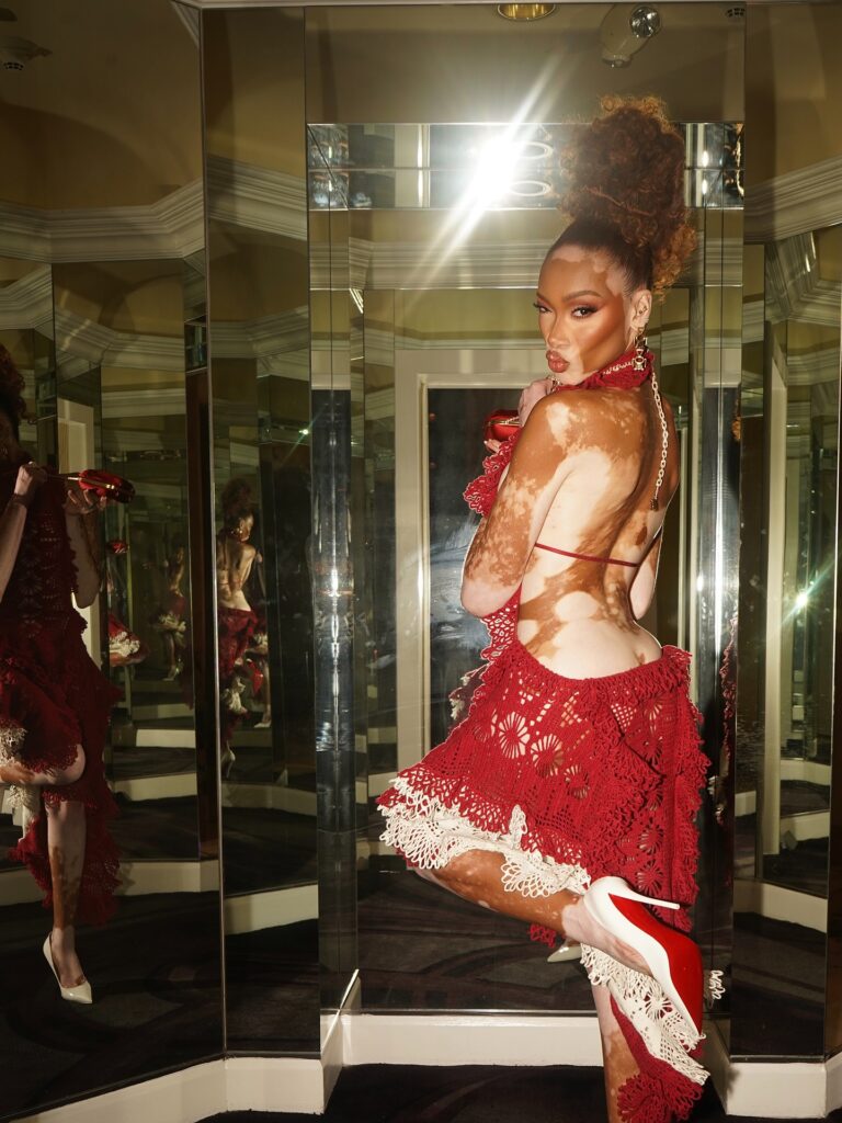 Winnie Harlow Net Worth, Wiki, Height, Age, Family, Boyfriend and Career Winnie Harlow body dimensions being roughly 34-26-34 inches. Her height measures 5 feet and 9 inches and weight comes in near 50 Kg.