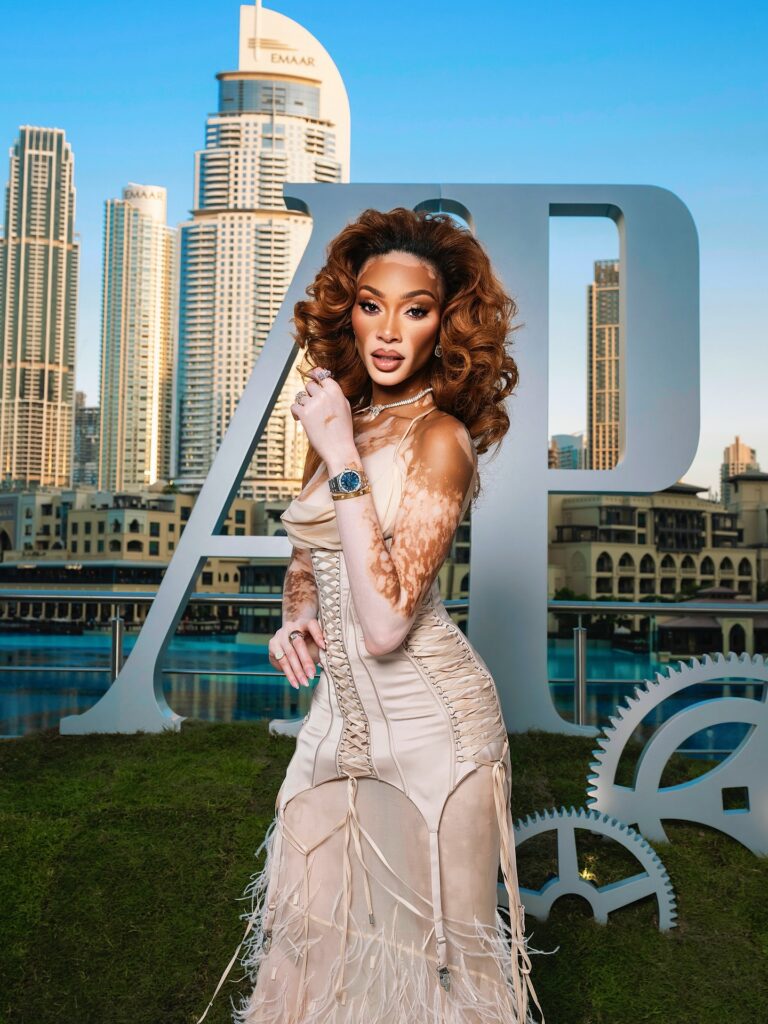 Winnie Harlow Net Worth, Wiki, Height, Age, Family, Boyfriend and Career Harlow became widely known back in 2014 after she appeared on the reality TV show "America's Next Top Model."