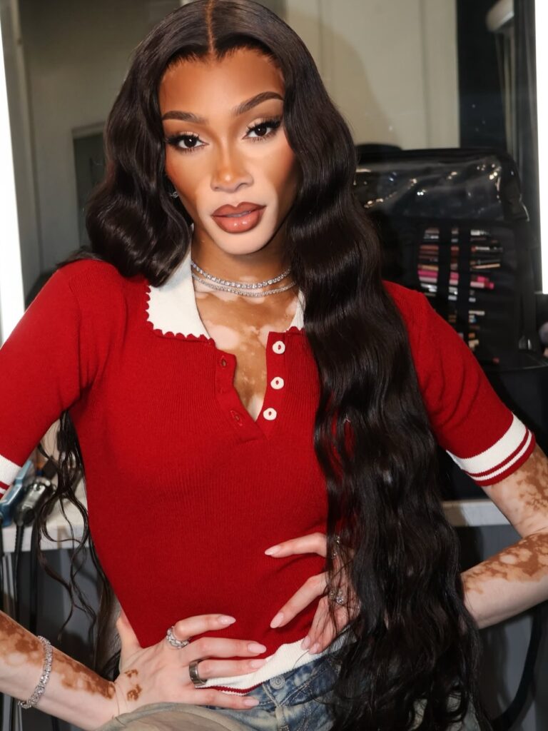 Winnie Harlow Net Worth, Wiki, Height, Age, Family, Boyfriend and Career Harlow created Cay Skin, a skincare and sun care brand, in early 2022.