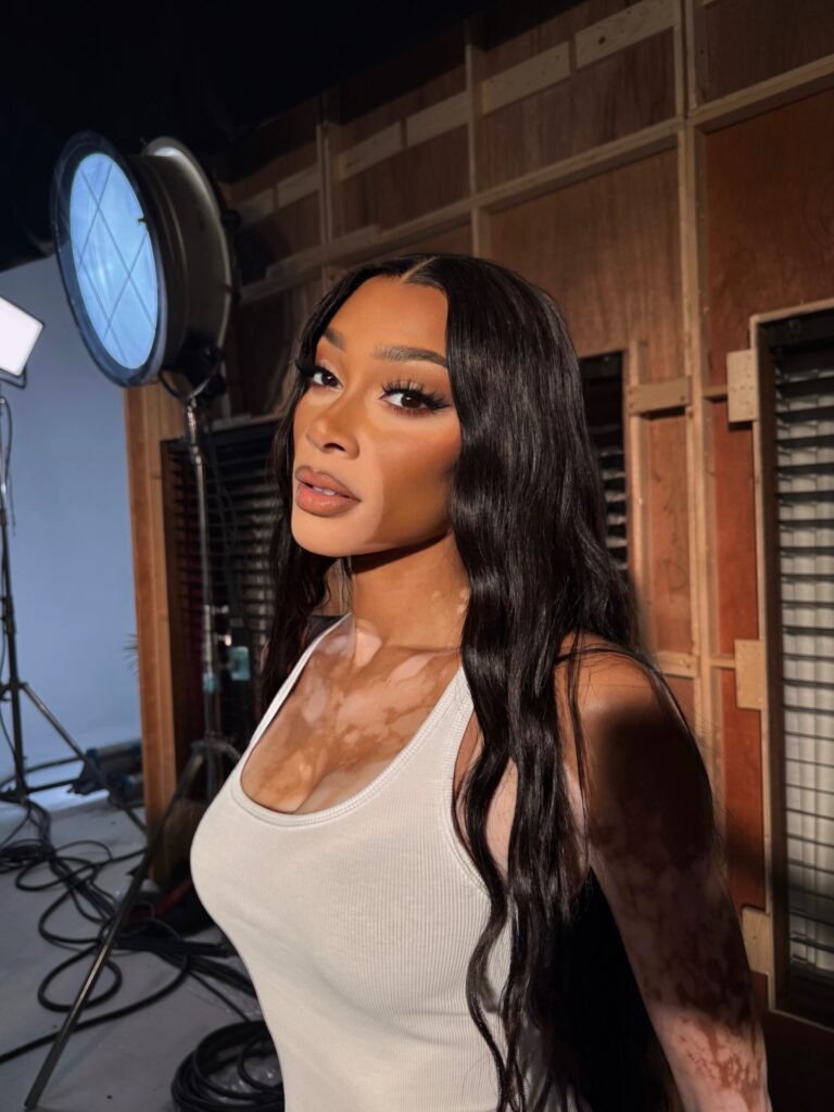 Winnie Harlow Net Worth, Wiki, Height, Age, Family, Boyfriend and Career Harlow began a fresh part of her love story by starting a relationship with American businessman Kyle Kuzma.