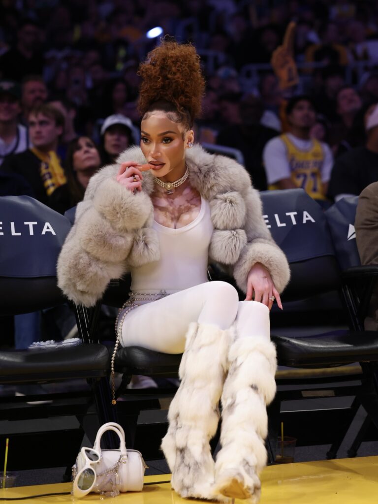 Winnie Harlow Net Worth, Wiki, Height, Age, Family, Boyfriend and Career Winnie Harlow Net Worth $5 Million